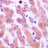 CFHR1 Rabbit Polyclonal Antibody