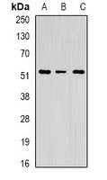 Chitotriosidase Rabbit Polyclonal Antibody