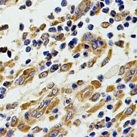 Chitotriosidase Rabbit Polyclonal Antibody