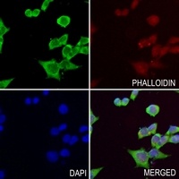Chitotriosidase Rabbit Polyclonal Antibody