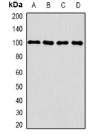 CLCN5 Rabbit Polyclonal Antibody