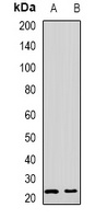 Tetranectin Rabbit Polyclonal Antibody