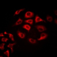 Tetranectin Rabbit Polyclonal Antibody