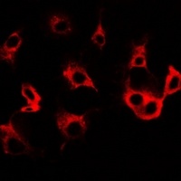 Cullin 5 Rabbit Polyclonal Antibody