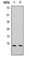 CXCL11 Rabbit Polyclonal Antibody