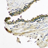 CXCL11 Rabbit Polyclonal Antibody