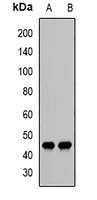 Decorin Rabbit Polyclonal Antibody