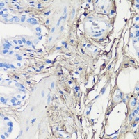 Decorin Rabbit Polyclonal Antibody