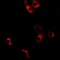 Decorin Rabbit Polyclonal Antibody