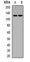 DLGAP5 Rabbit Polyclonal Antibody