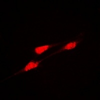 DLGAP5 Rabbit Polyclonal Antibody