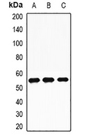TdT Rabbit Polyclonal Antibody
