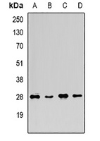 FGF14 Rabbit Polyclonal Antibody