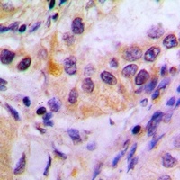 FKBP4 Rabbit Polyclonal Antibody