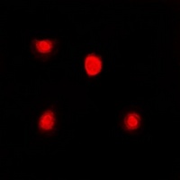FKBP4 Rabbit Polyclonal Antibody