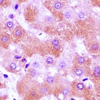 FURIN Rabbit Polyclonal Antibody