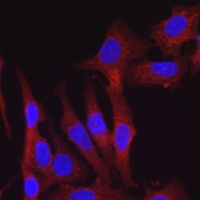 FURIN Rabbit Polyclonal Antibody
