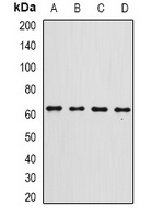 Gc-globulin Rabbit Polyclonal Antibody