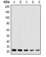 GFER Rabbit Polyclonal Antibody
