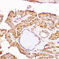 GFRA1 Rabbit Polyclonal Antibody