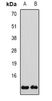 Glutaredoxin Rabbit Polyclonal Antibody