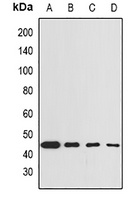 GNA13 Rabbit Polyclonal Antibody