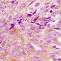 GNA13 Rabbit Polyclonal Antibody