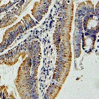 GNAI3 Rabbit Polyclonal Antibody