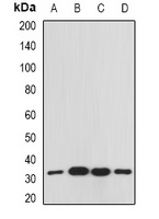 RACK1 Rabbit Polyclonal Antibody
