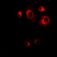 GRASP65 Rabbit Polyclonal Antibody