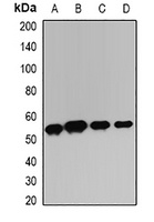 TIM3 Rabbit Polyclonal Antibody
