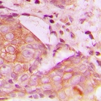 TIM3 Rabbit Polyclonal Antibody