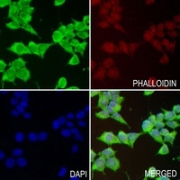 TIM3 Rabbit Polyclonal Antibody