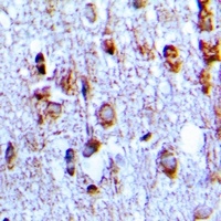 HCN1 Rabbit Polyclonal Antibody