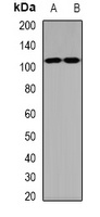 IDE Rabbit Polyclonal Antibody