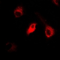 IDE Rabbit Polyclonal Antibody