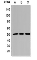 IFI44 Rabbit Polyclonal Antibody