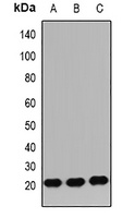 IGF2 Rabbit Polyclonal Antibody