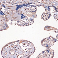 IGF2 Rabbit Polyclonal Antibody