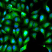 IGF2 Rabbit Polyclonal Antibody