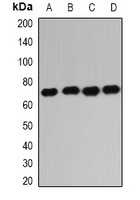 IGF2BP1 Rabbit Polyclonal Antibody