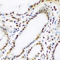 IGF2BP1 Rabbit Polyclonal Antibody