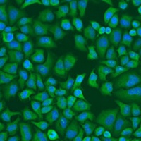 IGF2BP1 Rabbit Polyclonal Antibody