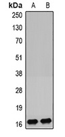 IGFBP4 Rabbit Polyclonal Antibody