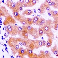 IGFBP4 Rabbit Polyclonal Antibody