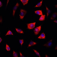 IGFBP4 Rabbit Polyclonal Antibody