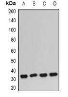 IGFBP5 Rabbit Polyclonal Antibody