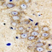 IGFBP5 Rabbit Polyclonal Antibody