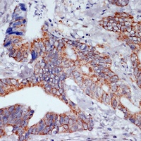 IKK epsilon Rabbit Polyclonal Antibody