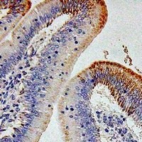 CD212 Rabbit Polyclonal Antibody